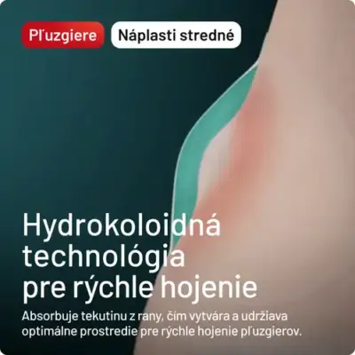 Compeed Náplasť na pľuzgiere STREDNÁ 5 ks – Obrázok 3