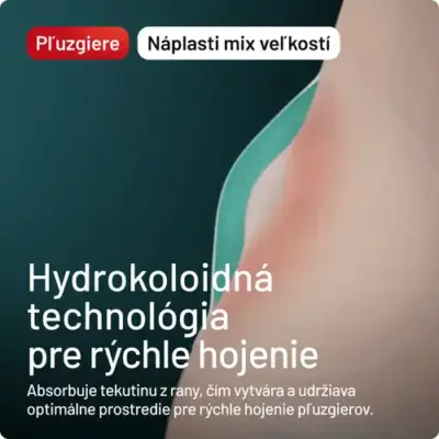 Compeed Náplasť na pľuzgiere MIX 5 ks – Obrázok 3