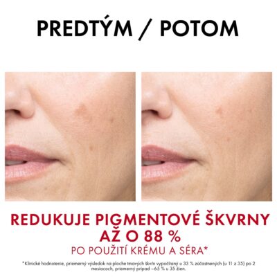 VICHY LIFTACTIV PIGMENT SPECIALIST B3 SPF 50 denný krém 50 ml – Obrázok 6