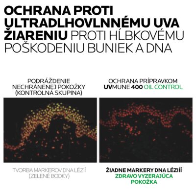 LA ROCHE-POSAY ANTHELIOS UVMUNE 400 SPF 50+ OIL CONTROL fluid 50 ml – Obrázok 6
