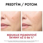 VICHY LIFTACTIV PIGMENT SPECIALIST B3 sérum 30 ml – Obrázok 7