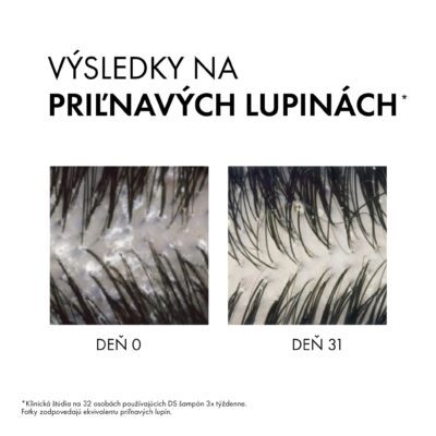 VICHY DERCOS Šampón a kondicionér 2v1 proti lupinám 200 ml – Obrázok 9