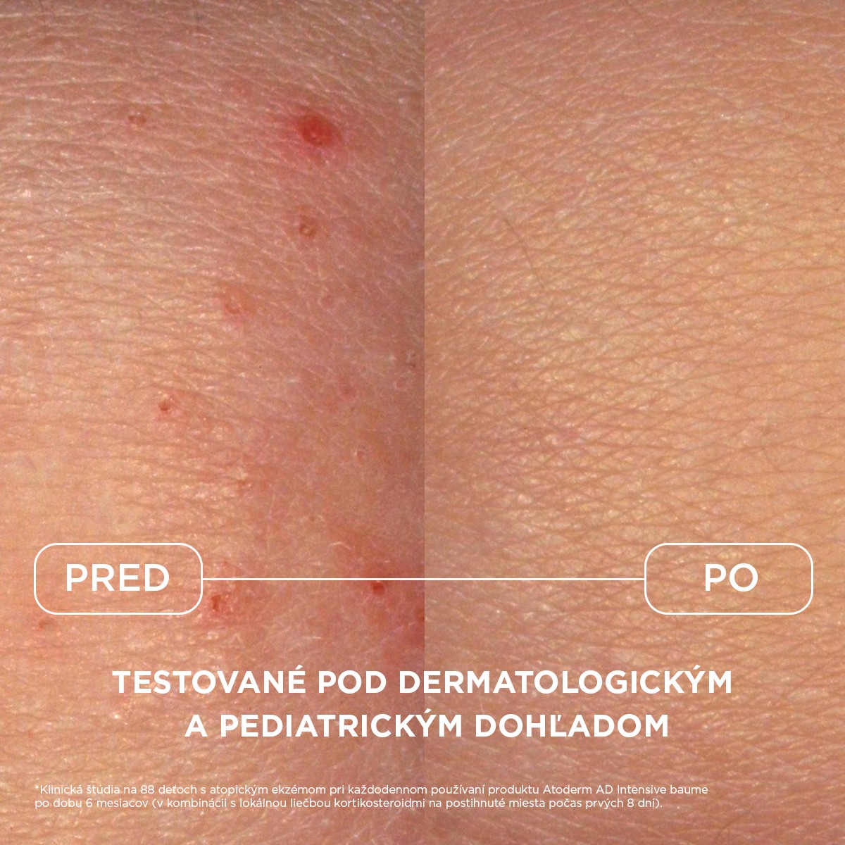 BIODERMA Atoderm AD Intensive baume balzam 400 ml – Obrázok 4
